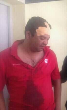 Bad buzz pour les militaires en tenue civile usant de la violence envers un avocat